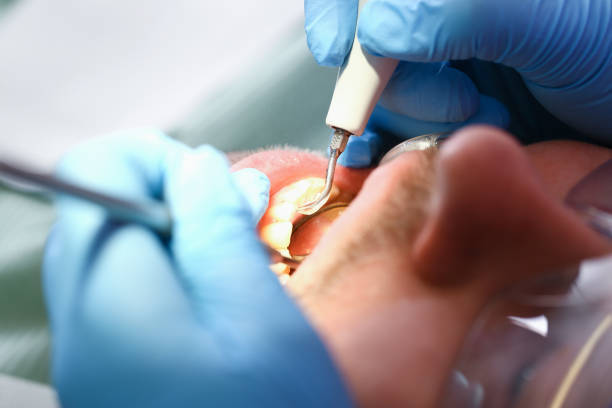 Best Pediatric Emergency Dentist in Bodega Bay, CA